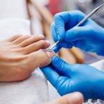 Pedicure leczniczy