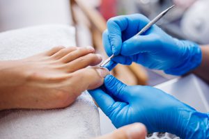 Pedicure leczniczy